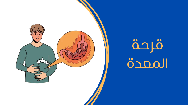 قرحة المعدة